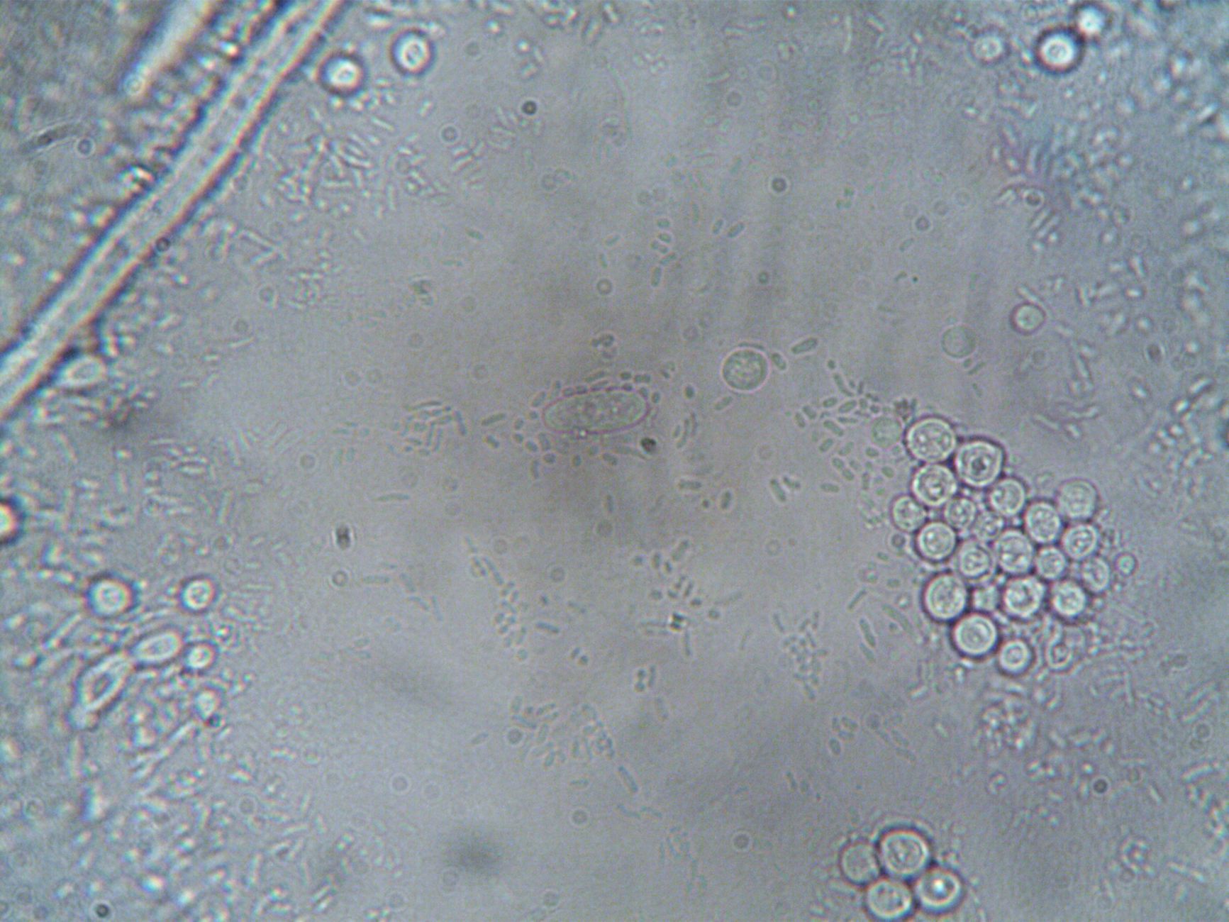 microscopic view of engineered bacteria cells blue and orange glow